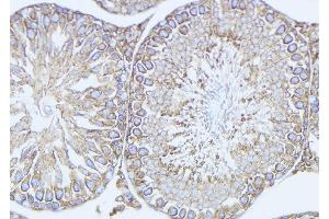 ABIN6272903 at 1/100 staining Mouse testis tissue by IHC-P. (ODF2 antibody  (Internal Region))