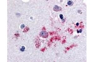 Immunohistochemistry (IHC) image for anti-Brain-Specific Angiogenesis Inhibitor 1 (BAI1) (N-Term) antibody (ABIN2469439) (BAI1 antibody  (N-Term))