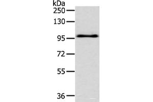 Western blot analysis of Hela cell using EPHA3 Polyclonal Antibody at dilution of 1:400 (EPH Receptor A3 antibody)