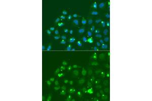 Immunofluorescence analysis of A549 cell using ATF3 antibody. (ATF3 antibody  (AA 1-181))