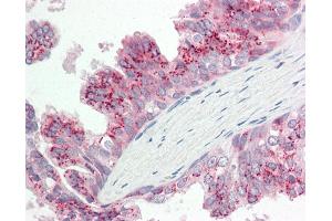 Human Prostate: Formalin-Fixed, Paraffin-Embedded (FFPE). (ATG4B antibody  (AA 110-159))