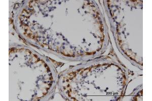 Immunoperoxidase of monoclonal antibody to RND3 on formalin-fixed paraffin-embedded human testis. (RND3 antibody  (AA 1-244))