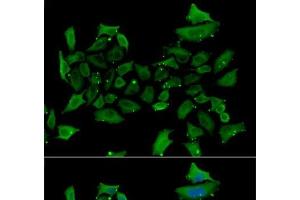 Immunofluorescence analysis of HeLa cells using ALAS1 Polyclonal Antibody