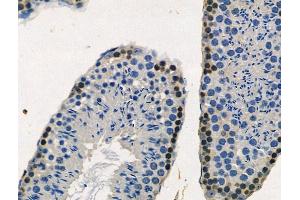ABIN6256199 and ABIN6267172 at 1/100 staining Mouse testis tissue by IHC-P.