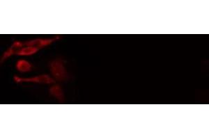 ABIN6277013 staining  HeLa cells by IF/ICC. (IFI16 antibody  (C-Term))