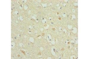 Immunohistochemistry of paraffin-embedded human brain tissue using ABIN7168273 at dilution of 1:100