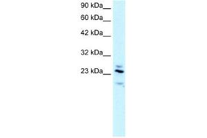 RGS20 antibody used at 2. (RGS20 antibody  (Middle Region))