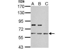 WB Image Sample (30 ug of whole cell lysate) A: NIH-3T3 B: JC C: BCL-1 7. (IMPDH2 antibody)