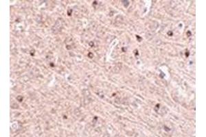 Immunohistochemistry of TOM70 in mouse brain tissue with this product at 2.