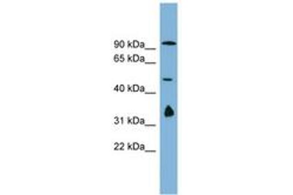 MAK10/NAA35 antibody  (AA 179-228)