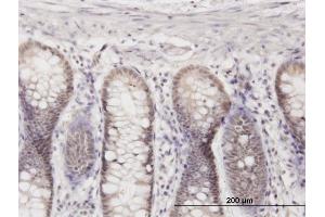 Immunoperoxidase of monoclonal antibody to CRSP8 on formalin-fixed paraffin-embedded human colon. (MED27 antibody  (AA 1-70))