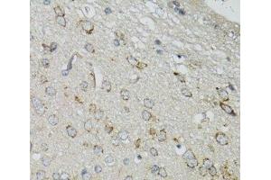 Immunohistochemistry of paraffin-embedded Mouse brain using DGUOK Polyclonal Antibody at dilution of 1:100 (40x lens). (Deoxyguanosine Kinase antibody)