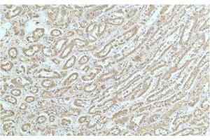 Immunohistochemistry of paraffin-embedded Human kidney tissue using ACTN1 Monoclonal Antibody at dilution of 1:200. (ACTN1 antibody)