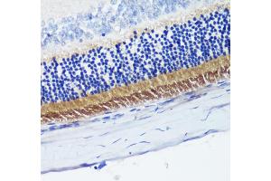 Immunohistochemistry of paraffin-embedded rat retina using PDE6B antibody (ABIN6132473, ABIN6145363, ABIN6145364 and ABIN6222688) at dilution of 1:200 (40x lens). (PDE6B antibody  (AA 1-190))