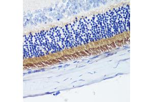 Immunohistochemistry of paraffin-embedded rat retina using PDE6B antibody (ABIN6132473, ABIN6145363, ABIN6145364 and ABIN6222688) at dilution of 1:200 (40x lens).