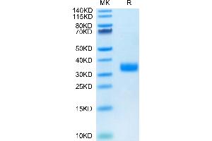 Human Angiopoietin-like 4 on Tris-Bis PAGE under reduced condition. (ANGPTL4 Protein (AA 166-406) (His tag))