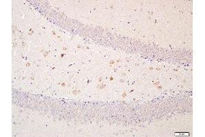Paraformaldehyde-fixed, paraffin embedded mouse brain, Antigen retrieval by boiling in sodium citrate buffer (pH6. (OPTN antibody  (AA 341-440))