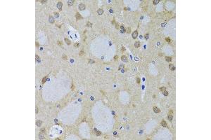 Immunohistochemistry of paraffin-embedded mouse brain using YWHAZ antibody. (14-3-3 zeta antibody  (AA 1-100))