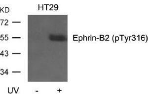 Western blot analysis of extracts from HT29 cells, untreated or treated with UV using Ephrin-B2 (Phospho-Tyr316). (Ephrin B2 antibody  (pTyr316))