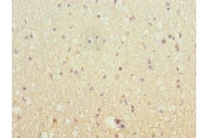 Immunohistochemistry of paraffin-embedded human brain tissue using ABIN7151640 at dilution of 1:100 (SH3G2 antibody  (AA 1-270))