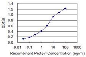Detection limit for recombinant GST tagged PARP1 is 0. (PARP1 antibody  (AA 1-100))