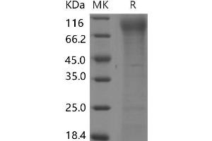 Western Blotting (WB) image for Fms-Related tyrosine Kinase 3 (FLT3) protein (His tag) (ABIN7320038) (FLT3 Protein (His tag))