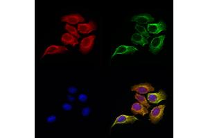 ABIN6261417 and ABIN6276966 staining Hela cells by IF/ICC.