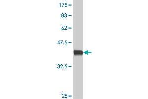 Western Blot detection against Immunogen (38. (RECQL2 antibody  (AA 1322-1432))