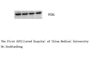 Western Blot (WB) analysis: Please contact us for more details. (PCNA antibody)