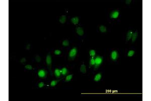 Immunofluorescence of purified MaxPab antibody to BIRC5 on HeLa cell. (Survivin antibody  (AA 1-142))