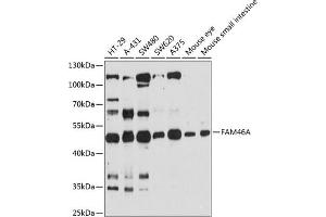 Western blot analysis of extracts of various cell lines, using FA antibody (ABIN6132080, ABIN6140461, ABIN6140462 and ABIN6216509) at 1:3000 dilution. (FAM46A antibody  (AA 180-400))