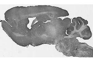 Adult rat brain immunohistochemistry.