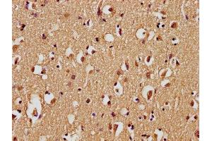 IHC image of ABIN7139743 diluted at 1:100 and staining in paraffin-embedded human brain tissue performed on a Leica BondTM system. (GPR77 antibody  (AA 2-19))