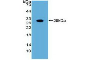 Detection of Recombinant FGFR3, Human using Polyclonal Antibody to Fibroblast Growth Factor Receptor 3 (FGFR3) (FGFR3 antibody  (AA 166-375))