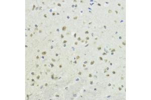 Immunohistochemistry of paraffin-embedded mouse brain using Phospho-Histone H3-T32 antibody (ABIN7267691) at dilution of 1:100 (40x lens).