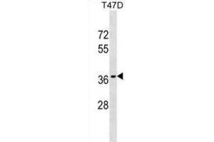 Western Blotting (WB) image for anti-Olfactory Receptor, Family 10, Subfamily T, Member 2 (OR10T2) antibody (ABIN3000574)