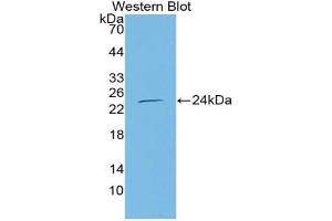 Western Blotting (WB) image for anti-Nitric Oxide Synthase 3 (Endothelial Cell) (NOS3) (AA 522-705) antibody (ABIN5014018)