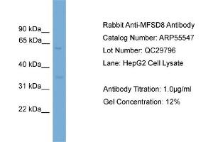 WB Suggested Anti-MFSD8  Antibody Titration: 0.