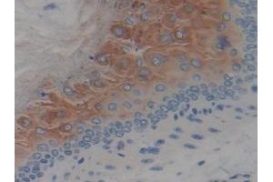 Detection of SPINK5 in Mouse Esophagus Tissue using Polyclonal Antibody to Serine Peptidase Inhibitor Kazal Type 5 (SPINK5) (SPINK5 antibody  (AA 734-995))