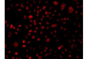 Immunofluorescence analysis of A549 cells using ARID1A antibody. (ARID1A antibody)