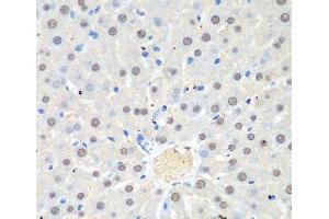Immunohistochemistry of paraffin-embedded Rat liver using WDR48 Polyclonal Antibody at dilution of 1:100 (40x lens). (WDR48 antibody)