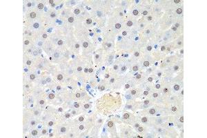 Immunohistochemistry of paraffin-embedded Rat liver using WDR48 Polyclonal Antibody at dilution of 1:100 (40x lens). (WDR48 antibody)