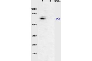 Lane 1: mouse embryo lysates Lane 2: rat brain lysates probed with Anti AVPR2 Polyclonal Antibody, Unconjugated (ABIN713231) at 1:200 in 4 °C. (RUNX2 antibody  (pSer451))