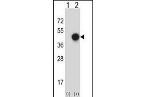 Western blot analysis of X (arrow) using rabbit polyclonal X Antibody (C-term) (ABIN657757 and ABIN2846739). (XPA antibody  (C-Term))