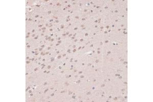 Immunohistochemistry of paraffin-embedded mouse brain using PRPF31 antibody (ABIN6132996, ABIN6146262, ABIN6146264 and ABIN6221399) at dilution of 1:100 (40x lens). (PRPF31 antibody  (AA 1-200))