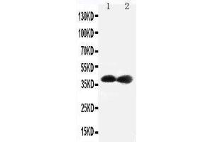 Anti-Cdk7 antibody,  Western blotting Lane 1: Rat Testis Tissue Lysate Lane 2: Rat Ovary Tissue Lysate (CDK7 antibody  (C-Term))