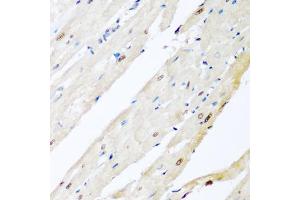 Immunohistochemistry of paraffin-embedded rat heart using VCP antibody (ABIN6290879) at dilution of 1:200 (40x lens). (VCP antibody)