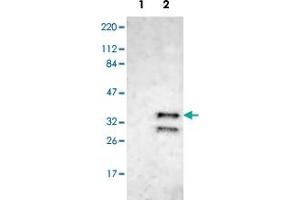 Western blot analysis of Lane 1: Human cell line RT-4; Lane 2: Human cell line U-251MG sp with CDK6 polyclonal antibody  at 1:100-1:250 dilution. (CDK6 antibody)