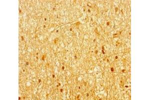 Immunohistochemistry of paraffin-embedded human brain tissue using ABIN7144657 at dilution of 1:100 (Aryl Hydrocarbon Receptor antibody  (AA 126-353))