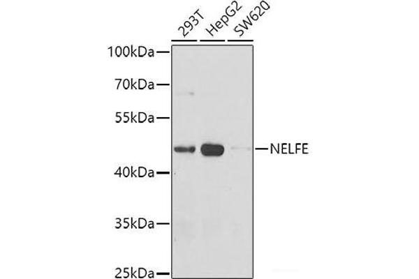 RDBP antibody